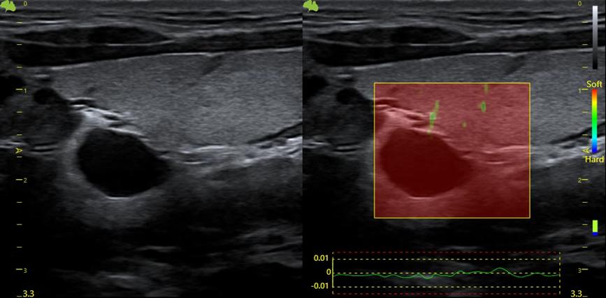 Máy siêu âm 5D Vinno S100